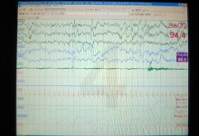 Working My Way Through a Sleep Disorder