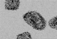 16-Year-Old Dies of Rabies in Santa Maria