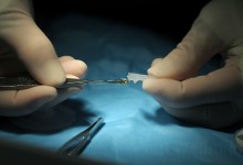 Eye Surgery Day Restores Sight for Nine