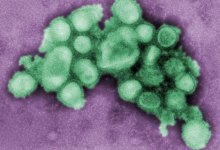 My Swine Flu Experience