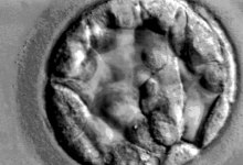 Cancer Vaccines: Part III