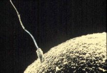 In Vitro Fertilization, Part II: Consequences