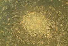 National Human Embryonic Stem Cell Research Obstructed
