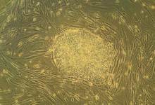 How to Make Your Own Stem Cells