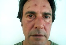 Man Tased 13 Times During Arrest