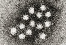 Hepatitis A Breaks Out in California