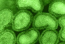 Flu Activity on the Rise in Santa Barbara County