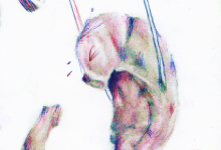 Is GPS Rotting Our Brains?