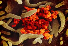 Santa Barbara County Has First Case of Coronavirus