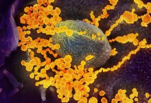 Quest Diagnostics Now Offering Antibody Test in Santa Barbara