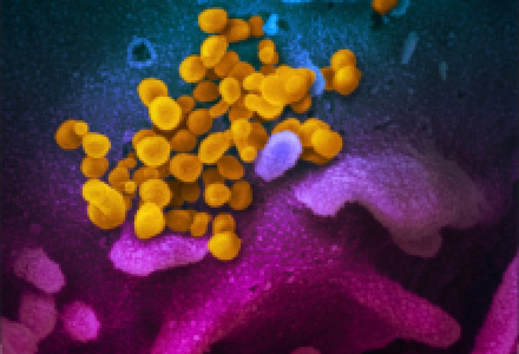 Santa Barbara County Reports 29th COVID Death, Orders Bars to Shut Down