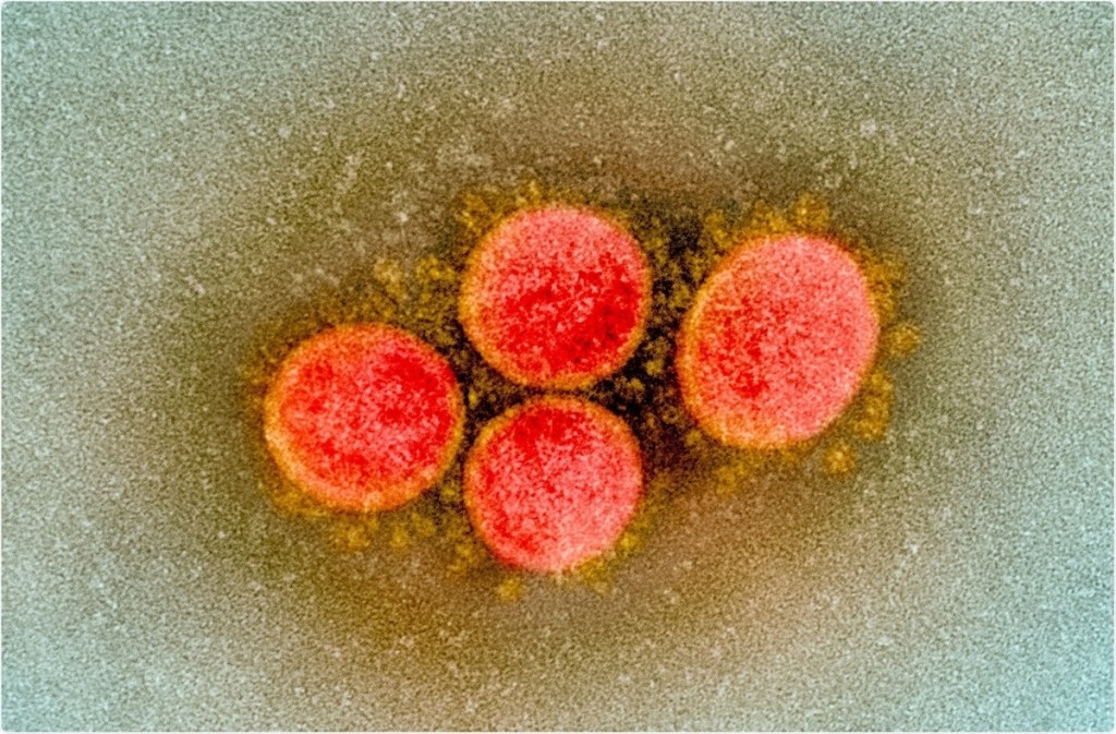 Two New Delta Variant Cases Found in Santa Barbara County - The Santa ...