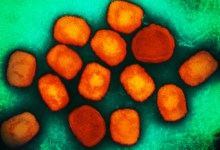 Monkeypox Second-Dose Vaccine Clinic in Santa Barbara County