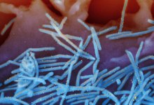 Cases of RSV Up Four-Fold in Santa Barbara