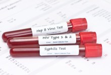 Syphilis Levels Rise in Santa Barbara County