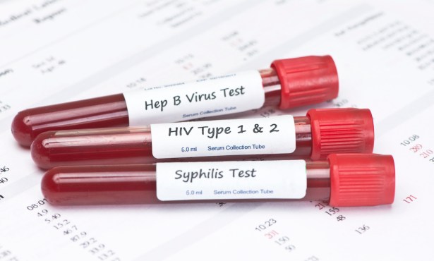 Syphilis Levels Rise in Santa Barbara County