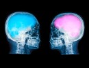 Gender on the Brain