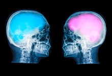 Gender on the Brain
