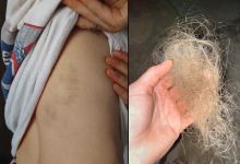 Santa Barbara Activist Among Victims of Reported Attack in West Bank