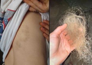 Santa Barbara Activist Among Victims of Reported Attack in West Bank