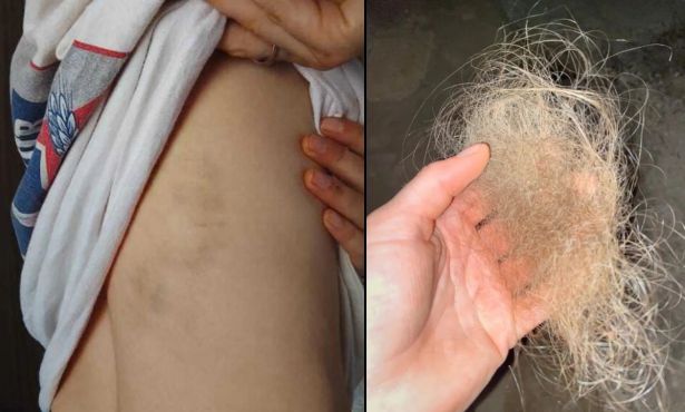 Santa Barbara Activist Among Victims of Reported Attack in West Bank