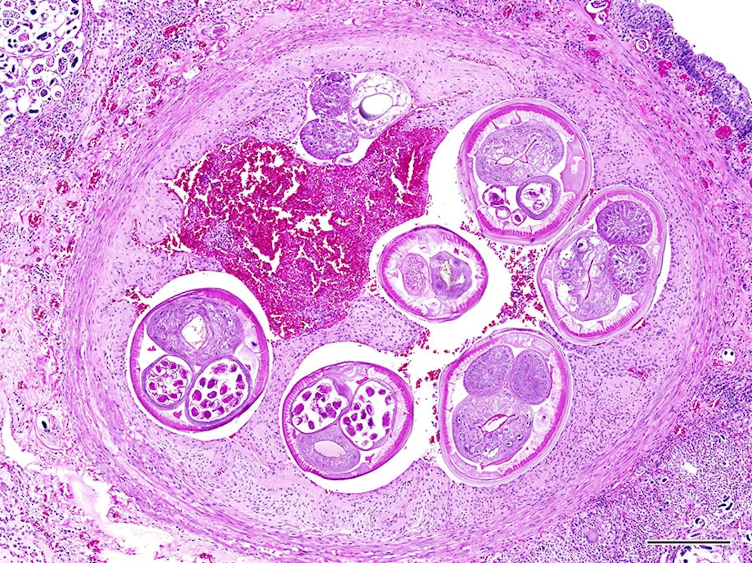 A Brain-Infecting Parasite Has Come to California. Should Santa Barbara Worry?