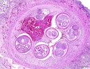 A Brain-Infecting Parasite Has Come to California. Should Santa Barbara Worry?