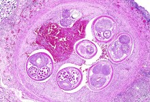 A Brain-Infecting Parasite Has Come to California. Should Santa Barbara Worry?