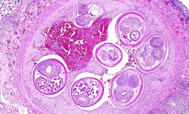 A Brain-Infecting Parasite Has Come to California. Should Santa Barbara Worry?