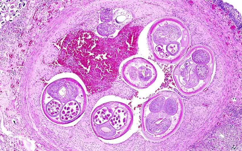 A Brain-Infecting Parasite Has Come to California. Should Santa Barbara Worry?