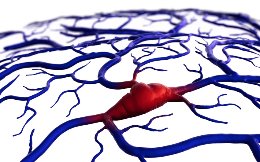 Brain Surgery by Autonomous Robot? It’s Possible — and Could Save Lives
